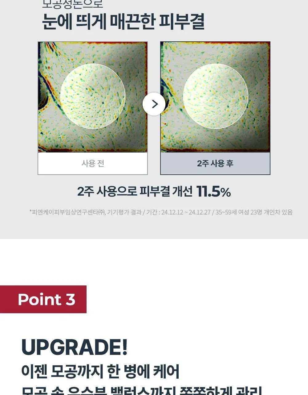 [5월 올영픽/리뉴얼] 유세린 하이알루론 부스팅 에센스 100ml 상세페이지 15